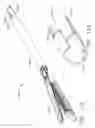 Fig. 79 - End effector coupling arrangements for a surgical cutting and stapling instrument