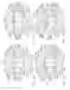 Fig. 26 - End effector for use with a surgical instrument
