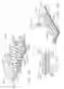 Fig. 30 - End effector for use with a surgical instrument