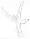 Fig. 02 - Flexible vascular occluding device