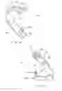 Fig. 08 - Hemostatic clip with needle passer