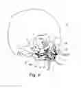 Fig. 06 - Orthognathic saw and positioning implant