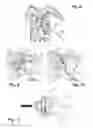Fig. 04 - Glenoid cavity bone preparation set for setting a shoulder prosthesis, and method for implanting a shoulder prosthesis