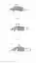 Fig. 03 - Apparatus and method for vessel occlusion removal