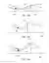 Fig. 22 - Apparatus and method for vessel occlusion removal