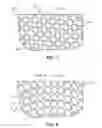 Fig. 05 - Surgical instrument having a surface texture
