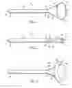Fig. 02 - THROMBECTOMY CATHETER
