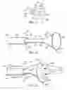 Fig. 03 - THROMBECTOMY CATHETER