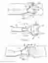 Fig. 05 - THROMBECTOMY CATHETER