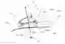 Fig. 01 - Placement manipulator and attachment for positioning a puncture instrument