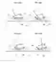 Fig. 24 - Placement manipulator and attachment for positioning a puncture instrument