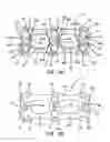 Fig. 04 - Anterior cervical plate