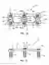Fig. 09 - Anterior cervical plate