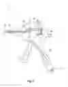 Fig. 07 - Multi-function surgical instruments