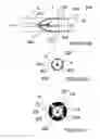 Fig. 03 - Methods and apparatus for performing a non-continuous circumferential treatment of a body lumen
