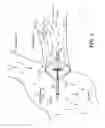 Fig. 05 - Vein occlusion assessment using temperature
