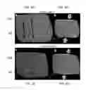 Fig. 06 - Biomechanical model assisted image guided surgery system and method