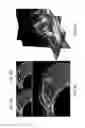 Fig. 07 - Biomechanical model assisted image guided surgery system and method