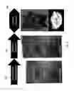 Fig. 10 - Biomechanical model assisted image guided surgery system and method