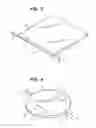 Fig. 03 - Advanced Orthodontic Retainer