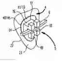 Fig. 01 - Bracket Extension System