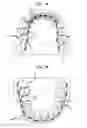 Fig. 03 - Bracket Extension System