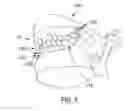 Fig. 06 - Method and system for generating a model of a subperiosteal dental implant device and customized implant head