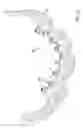 Fig. 11 - Method and system for generating a model of a subperiosteal dental implant device and customized implant head