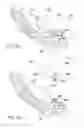 Fig. 12 - Method and system for generating a model of a subperiosteal dental implant device and customized implant head