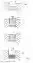 Fig. 02 - Method for the production of a dental restoration
