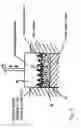 Fig. 03 - Method for the production of a dental restoration