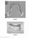 Fig. 03 - Method for determining a mapping of the contacts and/or distances between the maxillary and mandibular arches of a patient
