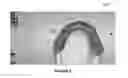 Fig. 04 - Method for determining a mapping of the contacts and/or distances between the maxillary and mandibular arches of a patient