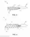 Fig. 04 - Implants and methods of implanting the same
