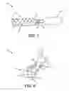 Fig. 05 - Implants and methods of implanting the same