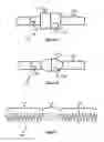 Fig. 04 - Embolic coils