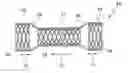 Fig. 01 - Stent