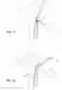 Fig. 09 - Surgical assembly for tissue repair