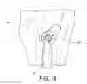 Fig. 11 - Surgical assembly for tissue repair