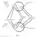 Fig. 05 - Accommodative intraocular lens that ejects post capsular opacification and self-centers