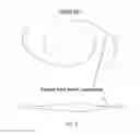 Fig. 06 - Accommodative intraocular lens that ejects post capsular opacification and self-centers