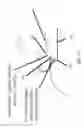Fig. 12 - Accommodative intraocular lens that ejects post capsular opacification and self-centers