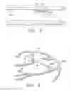 Fig. 04 - Systems, apparatus and methods for sealing perivalvular leaks