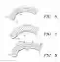 Fig. 05 - Systems, apparatus and methods for sealing perivalvular leaks