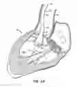 Fig. 09 - Replacement valve and anchor