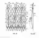 Fig. 02 - Everting heart valve