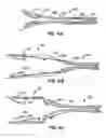 Fig. 06 - Everting heart valve