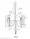 Fig. 18 - Everting heart valve