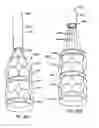 Fig. 41 - Everting heart valve