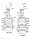 Fig. 42 - Everting heart valve